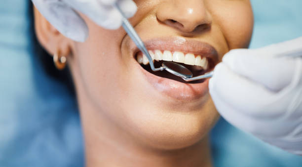 Best Emergency Dental Care for Abscessed Tooth in Smyrna, GA